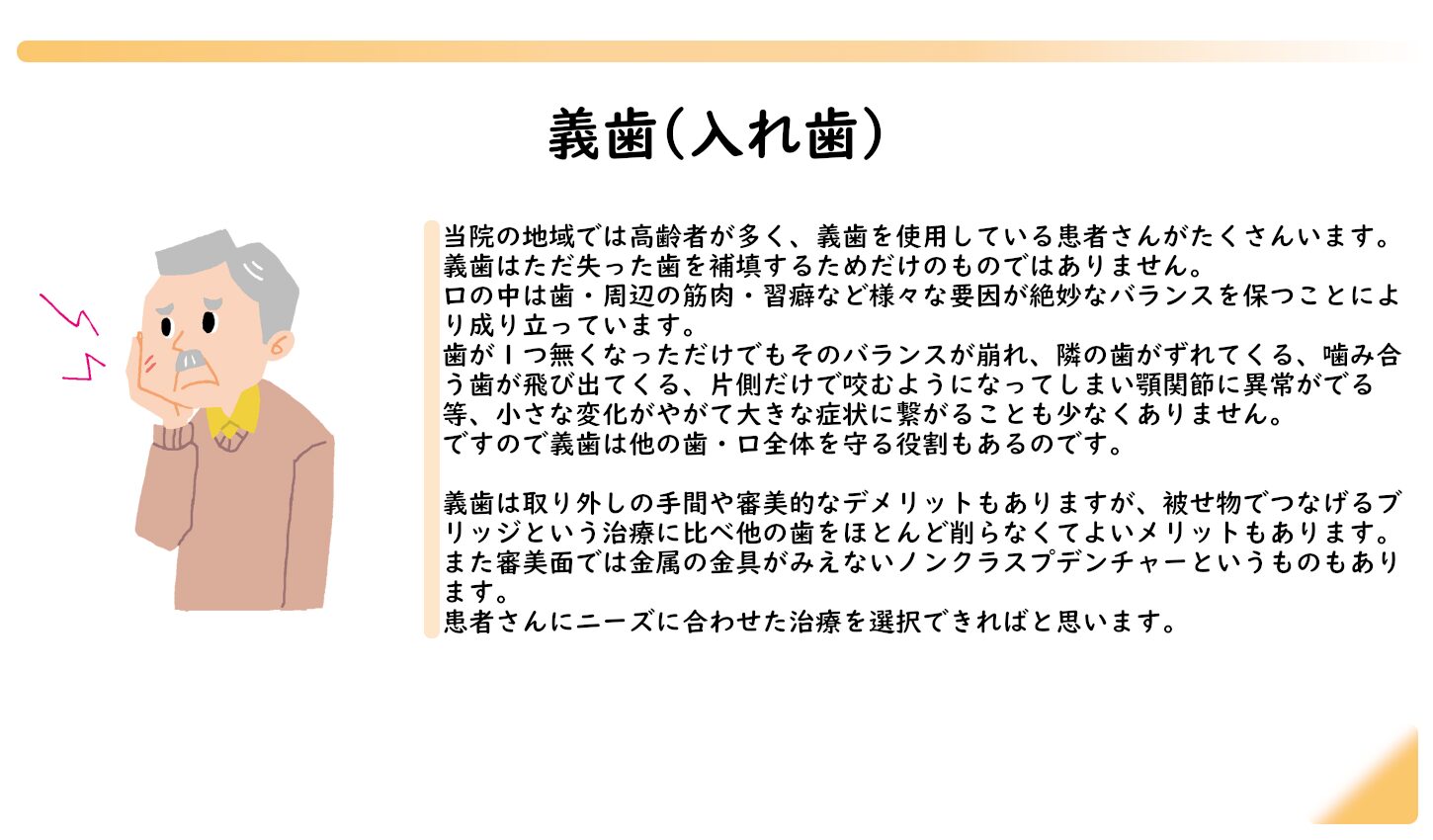 入れ歯　痛い　義歯